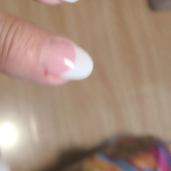 Oasis Nails by Rose - Bleeding cuticles - Waxing Near Me - Pompano Beach, Florida Oasis Nails by Rose - Bleeding cuticles - Waxing Near Me - Pompano Beach, Florida