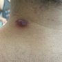 Photo of Skin and Cancer Institute - Redondo Beach