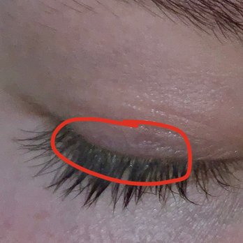 Lashifeyed - This is after washing with water using q tips and make up wipes! - Skin Care Near Me - West Jordan, Utah Lashifeyed - This is after washing with water using q tips and make up wipes! - Skin Care Near Me - West Jordan, Utah