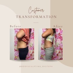 Side profile of my client after 5 sessions