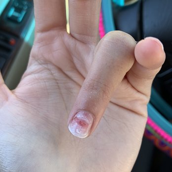Pearl Image Nails - My nail from when the lady took my polish off. - Nail Salons Near Me - Sacramento, California Pearl Image Nails - My nail from when the lady took my polish off. - Nail Salons Near Me - Sacramento, California