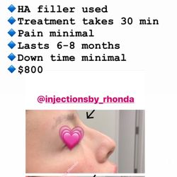 Absolute Integrated Med Spa - Plainfield - Rhonda Policandriotes RN BSN CANS Instagram @injectionsby_rhonda Facebook Rhonda Policandriotes #lipfillers #lipinjections #botox