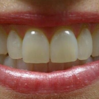 Radiant Dentistry - General Dentistry Near Me - Spartanburg, South Carolina Radiant Dentistry - General Dentistry Near Me - Spartanburg, South Carolina
