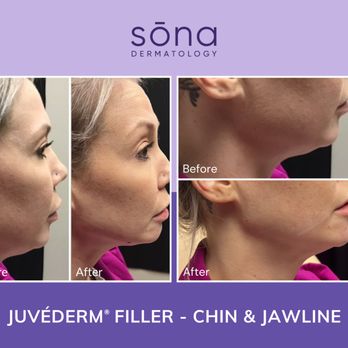 Sona MedSpa - Skin Care Near Me - Glen Allen, Virginia