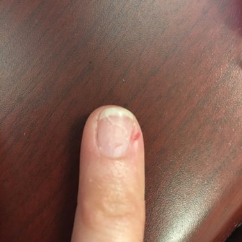 Paris Nail Bar - Cut finger and you can tell dipping powder was not fully removed - Wine Bars Near Me - Raleigh, North Carolina