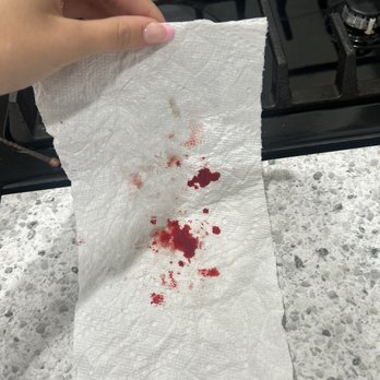 Bubbles N' Barks - This is what came from her paw after just one swipe with a paper towel. My poor baby. - Pet Groomers Near Me - St. Clair Shores, Michigan