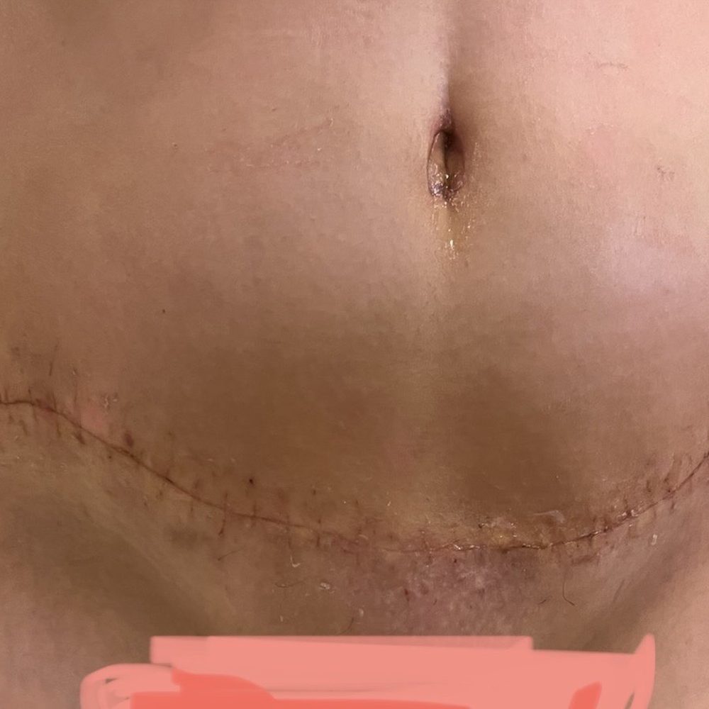 Barrett Plastic Surgery - Cosmetic Surgeons Near Me - Beverly Hills, California