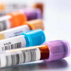 Core Flex Wellness - All Functional Health practice members are able to utilize our in office blood testing.
