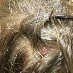 NAWI Wellness Center - I was telling truth that my granddaughter was getting stitches. And this secretary is rude and has no right working with public. I