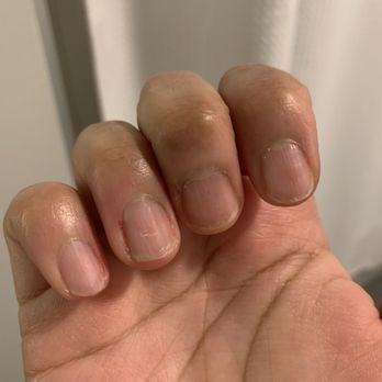 Red Nail Salon - Terrible manicure. Asked for oval shape and neat cuticles. Left with opposite. - Nail Salons Near Me - Chicago, Illinois Red Nail Salon - Terrible manicure. Asked for oval shape and neat cuticles. Left with opposite. - Nail Salons Near Me - Chicago, Illinois