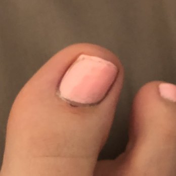 HN Passion Nails - Cut is still painful - Nail Salons Near Me - Glendale, California