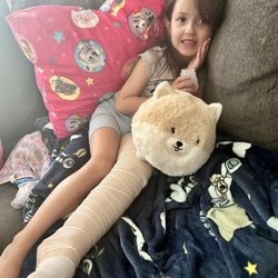 Broken leg