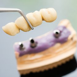 Alice P Moran, DMD - Dental Implants