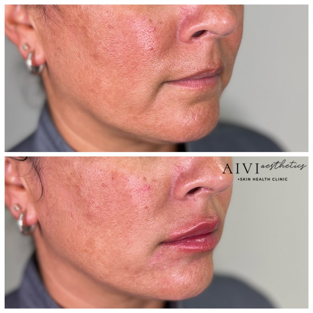 AIVI Aesthetics Logo