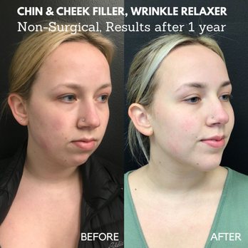 Juvly Aesthetics - Medical Spas Near Me - Chanhassen, Minnesota Juvly Aesthetics - Medical Spas Near Me - Chanhassen, Minnesota
