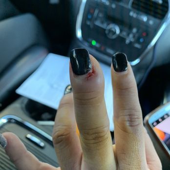 Q Nails - This is my aunts finger infected - Nail Salons Near Me - Dallas, Texas