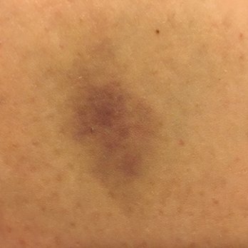 Radisson Blu Royal Viking Hotel - I believe this is Mirina's arm - Hotels Near Me - Stockholm, Alberta