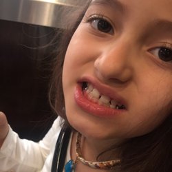 Rossanne M Sosa, DDS - Teeth are fixed and she is ready to have fun!!!