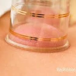 Naafiah Hijama and More Mobile Services - Dry cupping is great to help relax the muscles