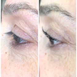 Body Beauty - Amazing results of LvL. Before and after treatment.