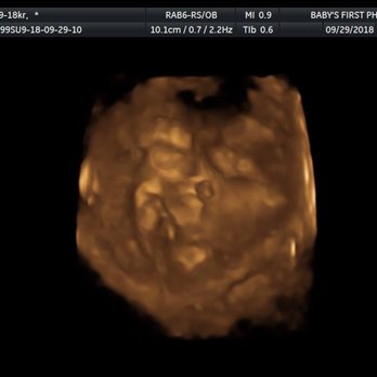 Baby's First Photos - Terrible us shots - Diagnostic Imaging Near Me - Bakersfield, California