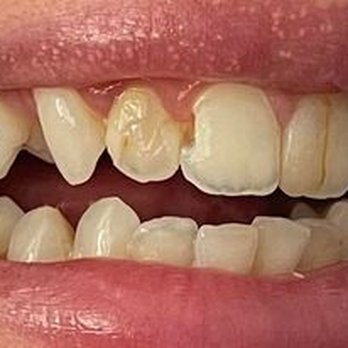 Chicago Holistic Dentistry - October 2022 - General Dentistry Near Me - Chicago, Illinois Chicago Holistic Dentistry - October 2022 - General Dentistry Near Me - Chicago, Illinois