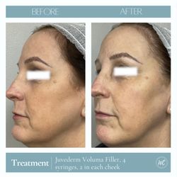 Wesley Chapel Laser and Aesthetics