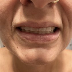 Monica Scheel, MD of Dermatology