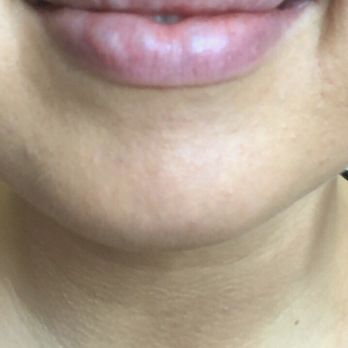 Beauty Lab + Laser Med Spa | Murray - Medical Spas Near Me - Murray, Utah Beauty Lab + Laser Med Spa | Murray - Medical Spas Near Me - Murray, Utah