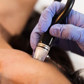Nu Bloom Esthetics - Silk Peel. Diamond Microdermabrasion with Serum Specific infusion. - Medical Spas Near Me - West Covina, California Nu Bloom Esthetics - Silk Peel. Diamond Microdermabrasion with Serum Specific infusion. - Medical Spas Near Me - West Covina, California