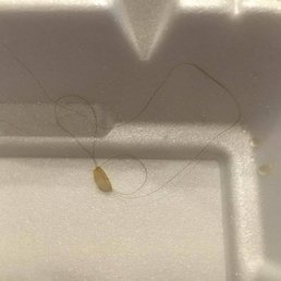 hair in my food and they could care less. hair in my food and they could care less.
