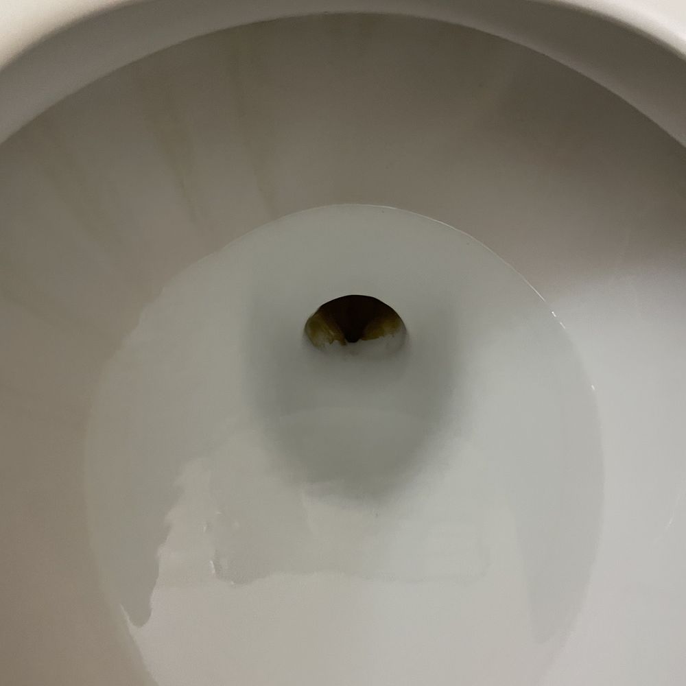 Holiday Inn Express - La Mesa - Toilets are easy to clean, so I don't know why the stains are still there. - Hotels Near Me - La Mesa, California