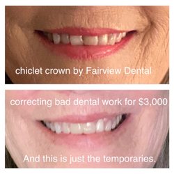Fairview Dental Care - Top picture poor, unacceptable chiclet crown. Their cosmetic dental work is inferior and third world quality.