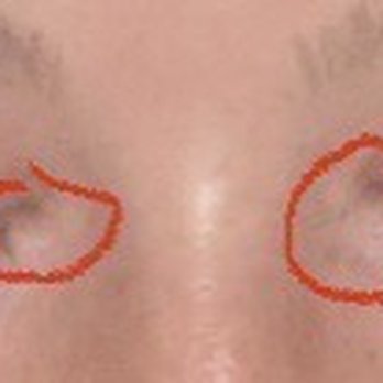 Amazing Lash Studio - Missing eyelashes - Eyelash Service Near Me - Chicago, Illinois