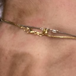 Hair dye left on neck