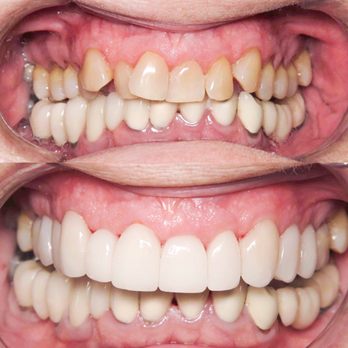 Daniel Garcia, DDS - Before and after! - General Dentistry Near Me - Downey, California Daniel Garcia, DDS - Before and after! - General Dentistry Near Me - Downey, California