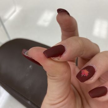 Fabulous Nails & Spa - Bubbling sticker, injured finger - Nail Salons Near Me - Upland, California