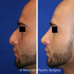 Mesbahi Plastic Surgery