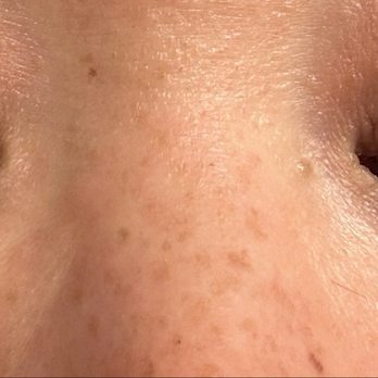 Lash O Holics - Again, picture after my lash lift, where's the lift? - Eyelash Service Near Me - Chicago, Illinois