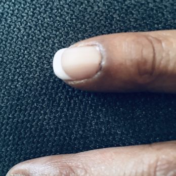 Neo Lashes & Nails - Infected cuticles. two weeks after service - Nail Salons Near Me - Aurora, Colorado