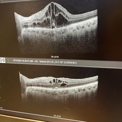University Ophthalmology Associates
