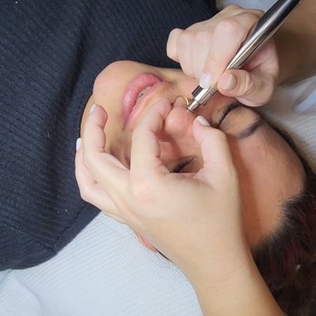 Esthetics.HD - Microdermabrasion facial! - Skin Care Near Me - Corona, California Esthetics.HD - Microdermabrasion facial! - Skin Care Near Me - Corona, California