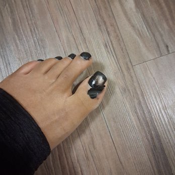 May97 Nail Studio - I took off my socks after day 2.... this is what I was greeted with! - Nail Technicians Near Me - Diamond Bar, California May97 Nail Studio - I took off my socks after day 2.... this is what I was greeted with! - Nail Technicians Near Me - Diamond Bar, California