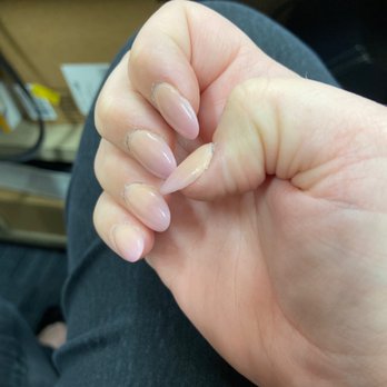 Millennium Nails & Spa - Crusty cuticles. Lifting acrylic on thumb. - Nail Salons Near Me - Riverside, California