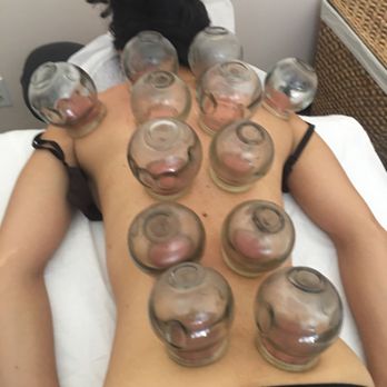 King Quon Wellness - Great cupping, feel so good! - Acupuncture Near Me - Santa Monica, California King Quon Wellness - Great cupping, feel so good! - Acupuncture Near Me - Santa Monica, California