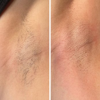 Estheticallyxe - Underarm Wax - Estheticians Near Me - Valley Center, California Estheticallyxe - Underarm Wax - Estheticians Near Me - Valley Center, California