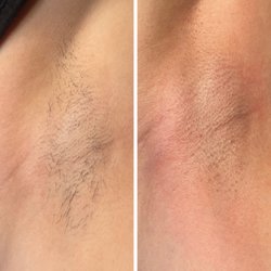 Estheticallyxe - Underarm Wax