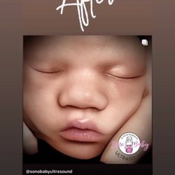 Sono Baby Ultrasound - After the the real view edit... absolutely amazing