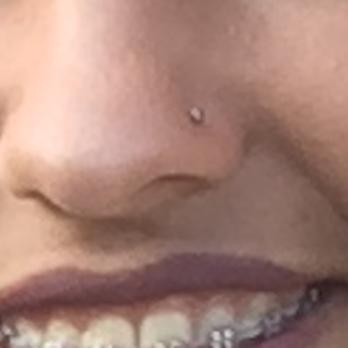 Zebra Tattoo & Body Piercing - Nose piercing a week after getting it pierced. - Tattoo Near Me - Berkeley, California Zebra Tattoo & Body Piercing - Nose piercing a week after getting it pierced. - Tattoo Near Me - Berkeley, California