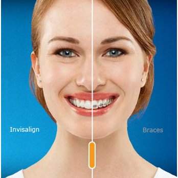 Dent-All By Dr Z - Add a caption - Cosmetic Dentists Near Me - Irvine, California
